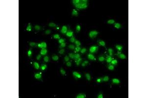 Immunofluorescence analysis of A-549 cells using WBSCR22 antibody (ABIN6132946, ABIN6150175, ABIN6150176 and ABIN6223157). (WBSCR22 Antikörper  (AA 1-281))