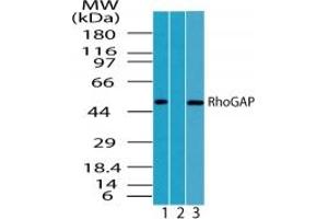Image no. 1 for anti-rho GTPase Activating Protein 1 (ARHGAP1) (AA 1-50) antibody (ABIN207682) (ARHGAP1 Antikörper  (AA 1-50))