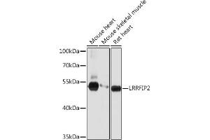 Western blot analysis of extracts of various cell lines, using LRRFIP2 Rabbit pAb (ABIN7268214) at 1:1000 dilution. (LRRFIP2 Antikörper  (AA 150-340))