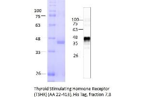 Image no. 2 for Thyroid Stimulating Hormone Receptor (TSHR) (AA 22-413) protein (His tag) (ABIN3150299) (TSH receptor Protein (AA 22-413) (His tag))