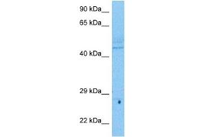 Host:  Rabbit  Target Name:  UBP48  Sample Tissue:  Human Lymph Node Tumor lysates  Antibody Dilution:  1ug/ml