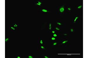 Immunofluorescence of purified MaxPab antibody to SCML1 on HeLa cell. (SCML1 Antikörper  (AA 1-208))