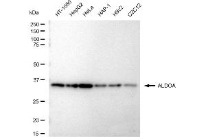 Western blotting analysis using ALDOA antibody (ABIN7797572).