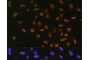 Immunofluorescence analysis of U-2 OS cells using Snail Polyclonal Antibody at dilution of 1:100. (SNAIL Antikörper)