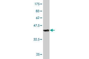 Western Blot detection against Immunogen (34. (DDX3Y Antikörper  (AA 1-80))