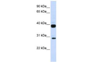 Flt3 Ligand antibody used at 1 ug/ml to detect target protein. (FLT3LG Antikörper  (N-Term))