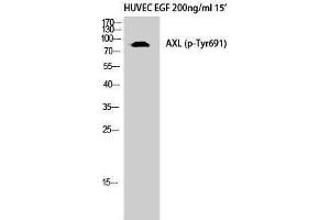 Western Blotting (WB) image for anti-AXL Receptor tyrosine Kinase (AXL) (pTyr691) antibody (ABIN3179699) (AXL Antikörper  (pTyr691))