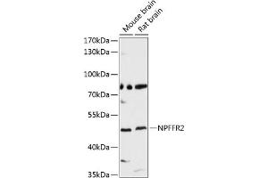 Western blot analysis of extracts of various cell lines, using NPFFR2 antibody (ABIN6128377, ABIN6144766, ABIN6144767 and ABIN6214924) at 1:3000 dilution. (NPFFR2 Antikörper  (AA 1-140))