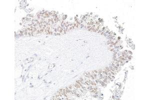 Immunohistochemistry (IHC) image for anti-Werner Helicase Interacting Protein 1 (WRNIP1) (AA 400-450) antibody (ABIN7454746) (WRNIP1 Antikörper  (AA 400-450))