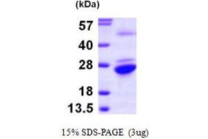 SDS-PAGE (SDS) image for Glucosamine-Phosphate N-Acetyltransferase 1 (GNPNAT1) (AA 1-184) protein (His tag) (ABIN667289)