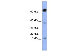 WB Suggested Anti-NKX6-3 Antibody Titration:  0. (NK6 Homeobox 3 Antikörper  (Middle Region))
