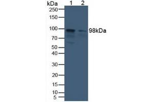 Western blot analysis of (1) Human Liver Tissue and (2) Human HeLa cells.