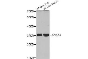 Western blot analysis of extracts of various cell lines, using ANXA4 antibody (ABIN6290015) at 1:1000 dilution. (Annexin IV Antikörper)