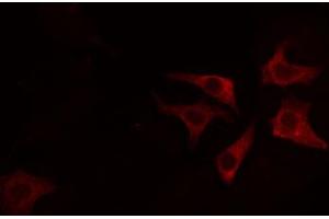 ABIN6274711 staining HeLa cells by IF/ICC. (AGPAT4 Antikörper  (Internal Region))