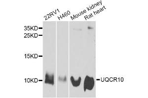Western blot analysis of extracts of various cell lines, using UQCR10 antibody. (UQCR10 Antikörper)