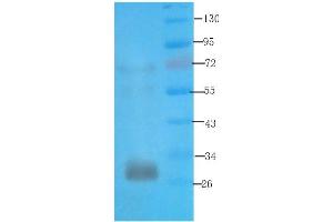 Western Blot using anti-syntaxin antibody ABIN7072248 Rat kidney lysate was resolved on a 12 % SDS PAGE gel and blots probed with ABIN7072248 at 3 μg/mL before being detected by a secondary antibody. (Rekombinanter Syntaxin Antikörper)