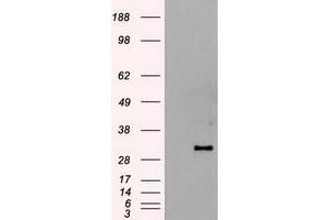 HEK293T cells were transfected with the pCMV6-ENTRY control (Left lane) or pCMV6-ENTRY HHex (RC204815) (Right lane) cDNA for 48 hrs and lysed. (HHEX Antikörper  (AA 100-270))