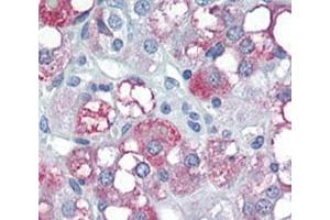 Immunohistochemistry (IHC) image for anti-Pyruvate Dehydrogenase Kinase, Isozyme 4 (PDK4) (AA 382-410) antibody (ABIN3028963)