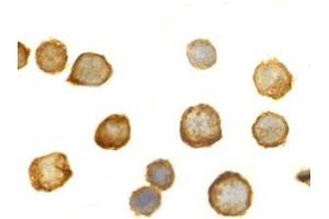 Immunocytochemistry of TLR5 in THP-1 cells with this product at 10 μg/ml. (TLR5 Antikörper  (C-Term))