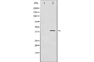 beta 2 Adrenergic Receptor Antikörper  (pSer346)