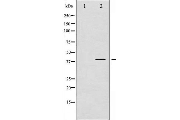 beta 2 Adrenergic Receptor Antikörper  (pSer346)