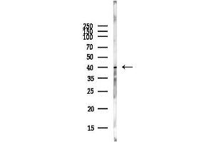 anti-Chemokine (C-X-C Motif) Receptor 4 (CXCR4) (C-Term) antibody