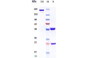 Anti-IL-5Ra/ CD125 Reference Antibody (benralizumab) on SDS-PAGE under reducing (R) condition.