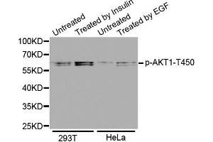 Western Blotting (WB) image for anti-V-Akt Murine Thymoma Viral Oncogene Homolog 1 (AKT1) (pThr450) antibody (ABIN1869963) (AKT1 Antikörper  (pThr450))