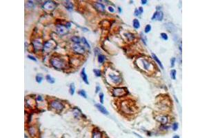 Used in DAB staining on fromalin fixed paraffin-embedded Stomach tissue (Connexin 31 Antikörper  (AA 7-102))