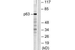 Western blot analysis of extracts from COS7 cells, using p63 antibody. (p63 Antikörper)