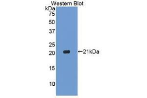 Western blot analysis of the recombinant protein. (Caspase 1 Antikörper  (AA 120-297))