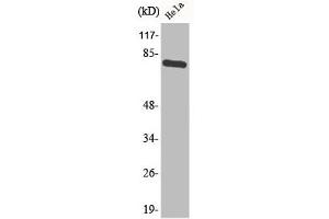 Western Blot analysis of HeLa cells using Phospho-p73 (Y99) Polyclonal Antibody (Tumor Protein p73 Antikörper  (pTyr99))