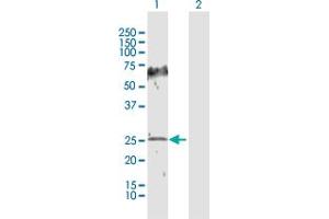 Western Blot analysis of HPGD expression in transfected 293T cell line by HPGD MaxPab polyclonal antibody. (HPGD Antikörper  (AA 1-266))