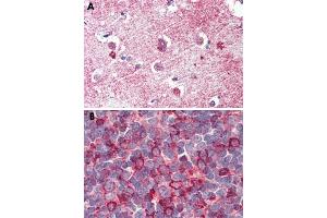 Immunohistochemical staining of formalin-fixed, paraffin-embedded human tonsil tissue after heat-induced antigen retrieval.