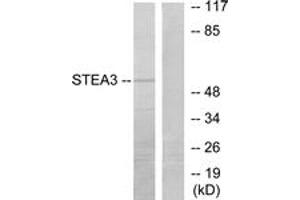 Western blot analysis of extracts from COLO205 cells, using STEA3 Antibody. (STEAP3 Antikörper  (AA 421-470))