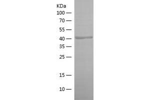 Western Blotting (WB) image for cAMP Responsive Element Binding Protein 1 (CREB1) (AA 1-341) protein (His tag) (ABIN7122112)