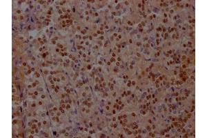 IHC image of ABIN7127582 diluted at 1:100 and staining in paraffin-embedded human adrenal gland tissue performed on a Leica BondTM system. (Rekombinanter ISL1 Antikörper)