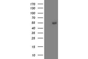 Western Blotting (WB) image for anti-Aminoacylase 1 (ACY1) antibody (ABIN1496456)