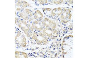 Immunohistochemistry of paraffin-embedded human gastric using OPA3 antibody at dilution of 1:100 (x40 lens).