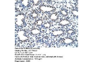 Rabbit Anti-SMARCD2 Antibody  Paraffin Embedded Tissue: Human Lung Cellular Data: Alveolar cells Antibody Concentration: 16 ug/ml Magnification: 400X (SMARCD2 Antikörper  (C-Term))