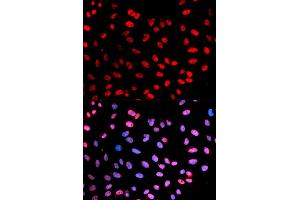 Immunofluorescence (IF) image for anti-Extra Spindle Poles Like 1 (ESPL1) (pSer1126) antibody (ABIN1876756) (Separase Antikörper  (pSer1126))