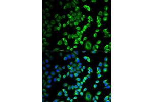 Immunofluorescence analysis of HeLa cells using SERPINH1 antibody.