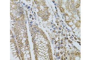 Immunohistochemistry of paraffin-embedded Human stomach using SELP Polyclonal Antibody at dilution of 1:100 (40x lens). (P-Selectin Antikörper)