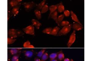 Immunofluorescence analysis of HeLa cells using ACVR2B Polyclonal Antibody at dilution of 1:100 (40x lens). (ACVR2B Antikörper)