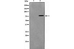 Western Blotting (WB) image for anti-Transglutaminase 2 (C Polypeptide, Protein-Glutamine-gamma-Glutamyltransferase) (TGM2) (N-Term) antibody (ABIN6265555)