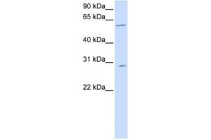 PNPLA4 antibody used at 1 ug/ml to detect target protein.