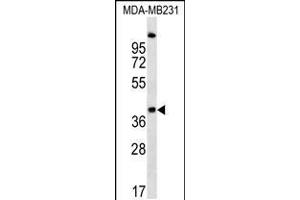 Western blot analysis in MDA-MB231 cell line lysates (35ug/lane). (RQCD1 Antikörper  (AA 106-134))