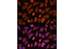 Immunofluorescence analysis of L929 cells using PHD2 antibody (ABIN3021559, ABIN3021560, ABIN3021561 and ABIN6215242) at dilution of 1:100. (EGLN1 Antikörper)