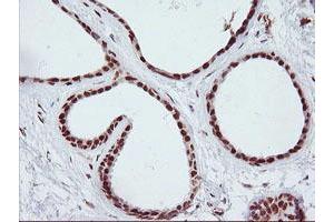 Immunohistochemical staining of paraffin-embedded Human breast tissue using anti-ENPEP mouse monoclonal antibody.