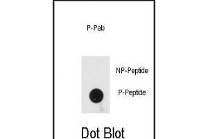 Dot blot analysis of anti-Phospho-PRKRA-p Antibody (ABIN389976 and ABIN2839767) on nitrocellulose membrane. (PRKRA Antikörper  (pSer246))